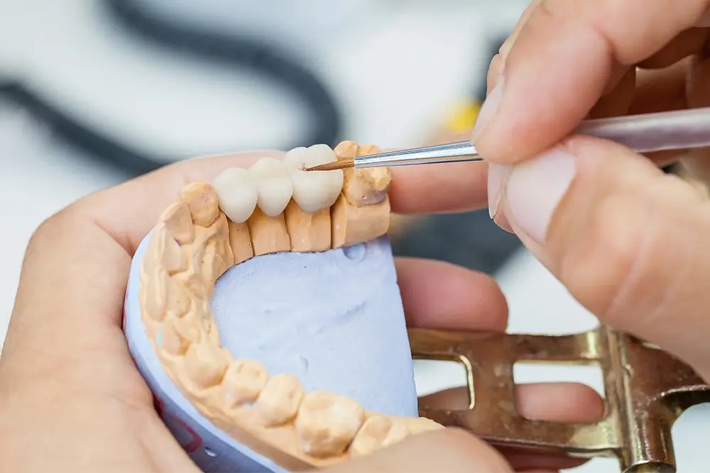 Traditional Crowns vs. CEREC Same-Day Crowns: Which is Better?